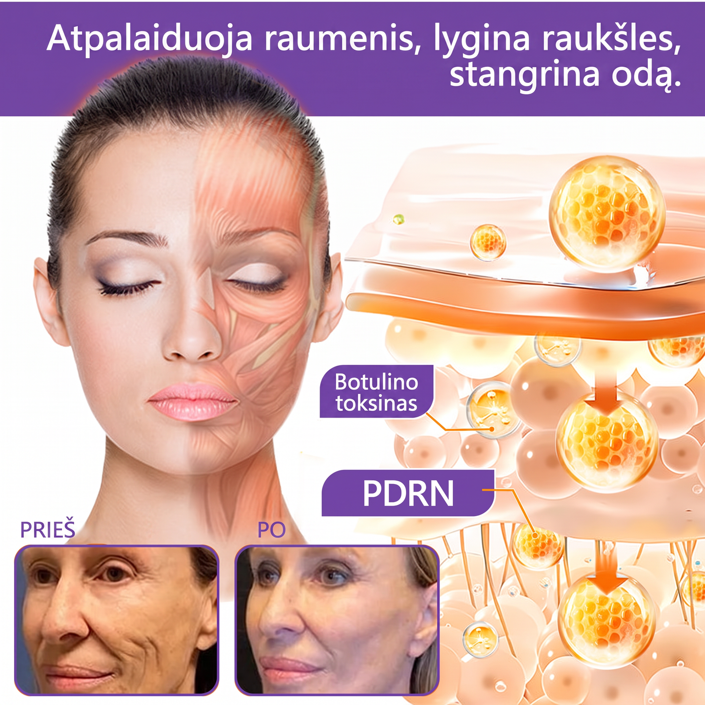 🇱🇹 Dermatologų rekomenduojama🥇 | 🍎Vitalisys® PDRN“daugiapeptidis masažuojamasis kūno kremas – Anti-senėjimo, drėkinamasis,stangrinamasis,odą regeneruojantis,sulyginantis,spuogų ir dėmių šalinimo,karpų ir apgamų šalinimo, psoriazės palengvinimo priemonė.❤️