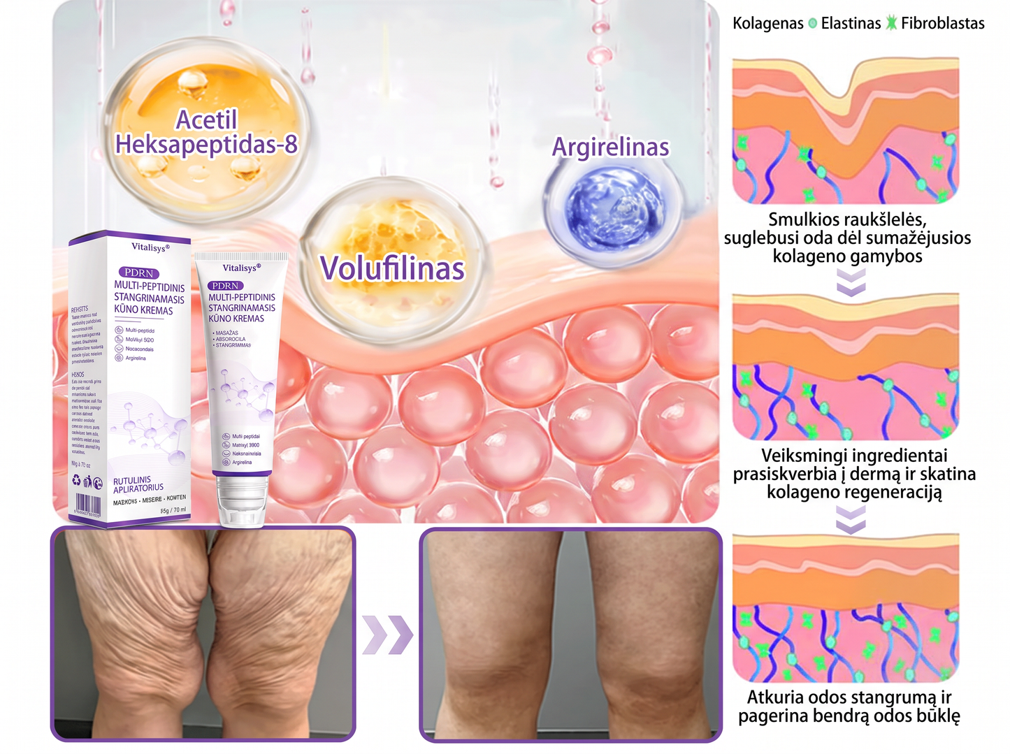 🇱🇹 Dermatologų rekomenduojama🥇 | 🍎Vitalisys® PDRN“daugiapeptidis masažuojamasis kūno kremas – Anti-senėjimo, drėkinamasis,stangrinamasis,odą regeneruojantis,sulyginantis,spuogų ir dėmių šalinimo,karpų ir apgamų šalinimo, psoriazės palengvinimo priemonė.❤️