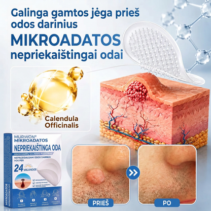 👩‍⚕️💯 Oficiální obchod | MURWON® 🌥️ Mikrojehličková náplast pro odstranění kožních nedokonalostí (Pro kožní výrůstky, drobné kožní útvary, bradavice, mateřská znaménka, stařecké skvrny a pigmentové nepravidelnosti.)❤️