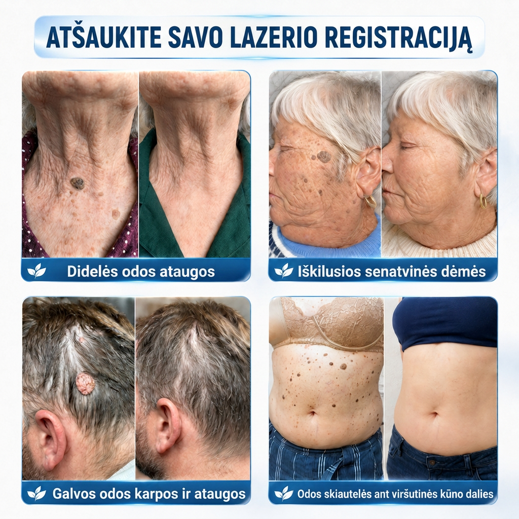 👩‍⚕️💯 Oficiální obchod | MURWON® 🌥️ Mikrojehličková náplast pro odstranění kožních nedokonalostí (Pro kožní výrůstky, drobné kožní útvary, bradavice, mateřská znaménka, stařecké skvrny a pigmentové nepravidelnosti.)❤️