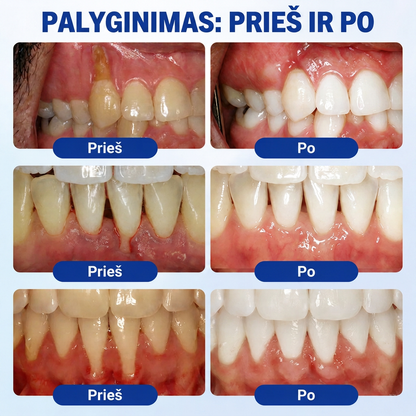 Rekomenduojamas odontologų 👨‍⚕️🦷🛡️ Vitalisys® GumRevive – regeneruojantis dantenų gelis 🐟💙