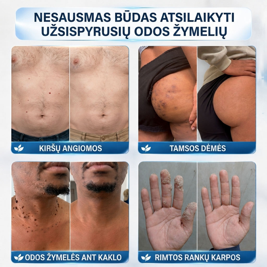 👩‍⚕️💯 Oficiální obchod | MURWON® 🌥️ Mikrojehličková náplast pro odstranění kožních nedokonalostí (Pro kožní výrůstky, drobné kožní útvary, bradavice, mateřská znaménka, stařecké skvrny a pigmentové nepravidelnosti.)❤️
