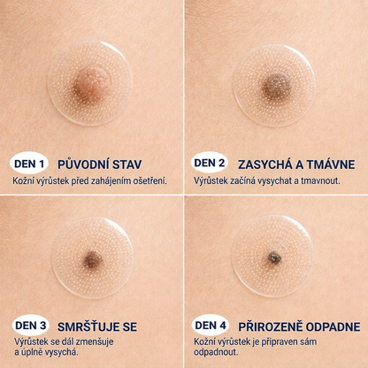 👩‍⚕️💯 Oficiální obchod | MURWON® 🌥️ Mikrojehličková náplast pro odstranění kožních nedokonalostí (Pro kožní výrůstky, drobné kožní útvary, bradavice, mateřská znaménka, stařecké skvrny a pigmentové nepravidelnosti.)❤️