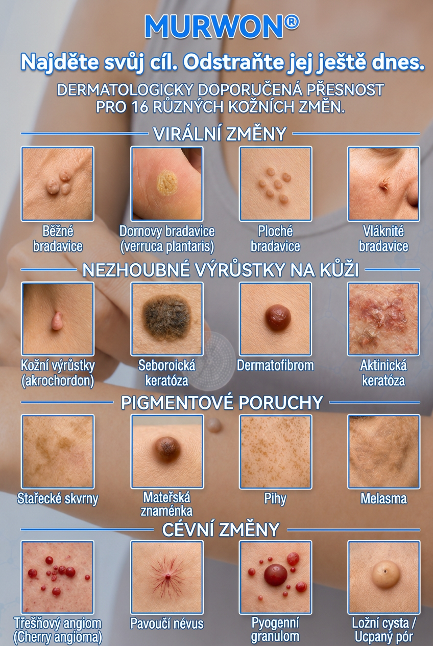 👩‍⚕️💯 Oficiální obchod | MURWON® 🌥️ Mikrojehličková náplast pro odstranění kožních nedokonalostí (Pro kožní výrůstky, drobné kožní útvary, bradavice, mateřská znaménka, stařecké skvrny a pigmentové nepravidelnosti.)❤️