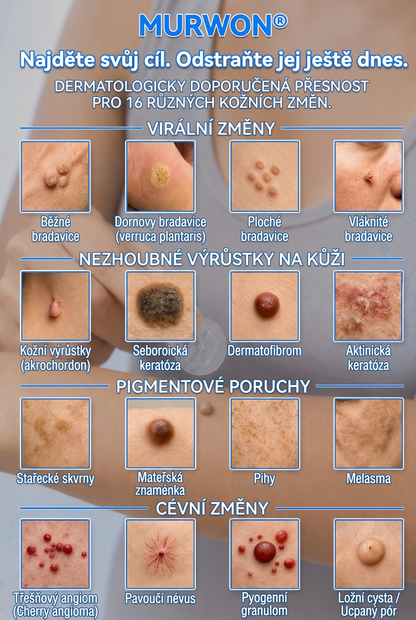 👩‍⚕️💯 Oficiální obchod | MURWON® 🌥️ Mikrojehličková náplast pro odstranění kožních nedokonalostí (Pro kožní výrůstky, drobné kožní útvary, bradavice, mateřská znaménka, stařecké skvrny a pigmentové nepravidelnosti.)❤️