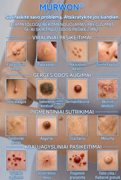 👩‍⚕️💯 Oficiální obchod | MURWON® 🌥️ Mikrojehličková náplast pro odstranění kožních nedokonalostí (Pro kožní výrůstky, drobné kožní útvary, bradavice, mateřská znaménka, stařecké skvrny a pigmentové nepravidelnosti.)❤️