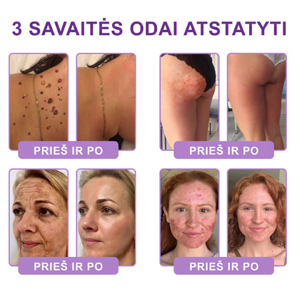 🇱🇹 Dermatologų rekomenduojama🥇 | 🍎Vitalisys® PDRN“daugiapeptidis masažuojamasis kūno kremas – Anti-senėjimo, drėkinamasis,stangrinamasis,odą regeneruojantis,sulyginantis,spuogų ir dėmių šalinimo,karpų ir apgamų šalinimo, psoriazės palengvinimo priemonė.❤️