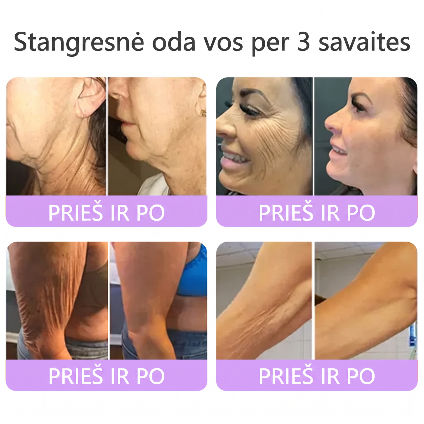 🇱🇹 Dermatologų rekomenduojama🥇 | 🍎Vitalisys® PDRN“daugiapeptidis masažuojamasis kūno kremas – Anti-senėjimo, drėkinamasis,stangrinamasis,odą regeneruojantis,sulyginantis,spuogų ir dėmių šalinimo,karpų ir apgamų šalinimo, psoriazės palengvinimo priemonė.❤️