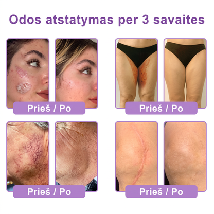🇱🇹 Dermatologų rekomenduojama🥇 | 🍎Vitalisys® PDRN“daugiapeptidis masažuojamasis kūno kremas – Anti-senėjimo, drėkinamasis,stangrinamasis,odą regeneruojantis,sulyginantis,spuogų ir dėmių šalinimo,karpų ir apgamų šalinimo, psoriazės palengvinimo priemonė.❤️