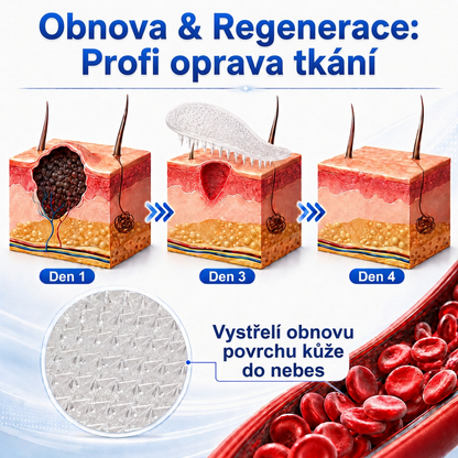 👩‍⚕️💯 Oficiální obchod | MURWON® 🌥️ Mikrojehličková náplast pro odstranění kožních nedokonalostí (Pro kožní výrůstky, drobné kožní útvary, bradavice, mateřská znaménka, stařecké skvrny a pigmentové nepravidelnosti.)❤️