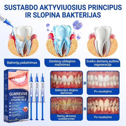 Rekomenduojamas odontologų 👨‍⚕️🦷🛡️ Vitalisys® GumRevive – regeneruojantis dantenų gelis 🐟💙