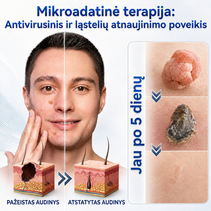 👩‍⚕️💯 Oficiální obchod | MURWON® 🌥️ Mikrojehličková náplast pro odstranění kožních nedokonalostí (Pro kožní výrůstky, drobné kožní útvary, bradavice, mateřská znaménka, stařecké skvrny a pigmentové nepravidelnosti.)❤️
